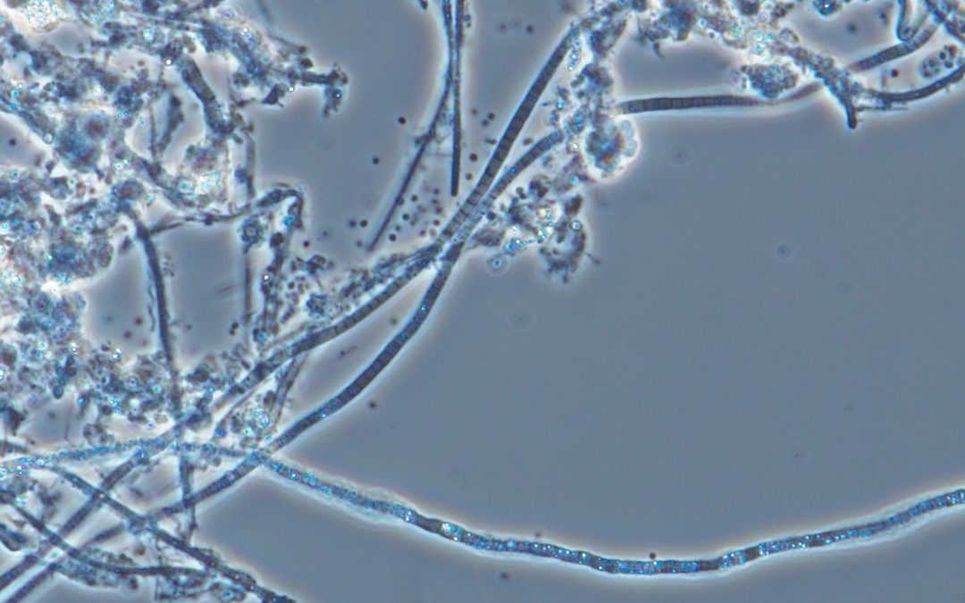Filamentous Bacteria in Aerated Stabilization Basins Part 2