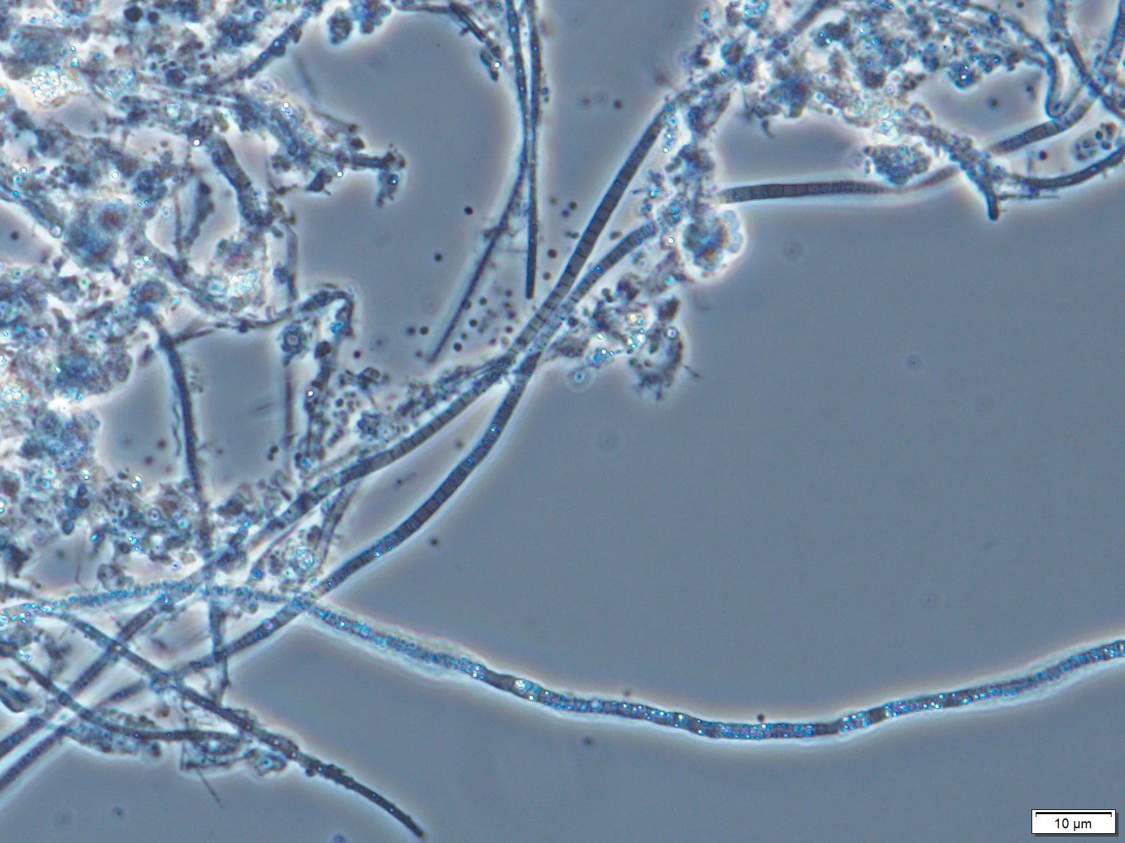Filamentous Bacteria in Aerated Stabilization Basins Part 2
