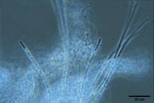 Filamentous Bacteria in Aerated Stabilization Basins Part 2