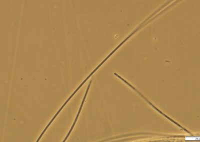Microscopic image of a Sphaerotilus Natan
