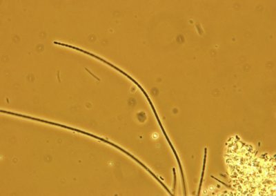 Microscopic image of a Sphaerotilus Natan