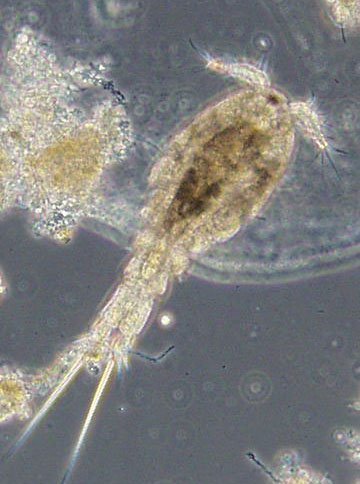 Microscopic image of a water flea.