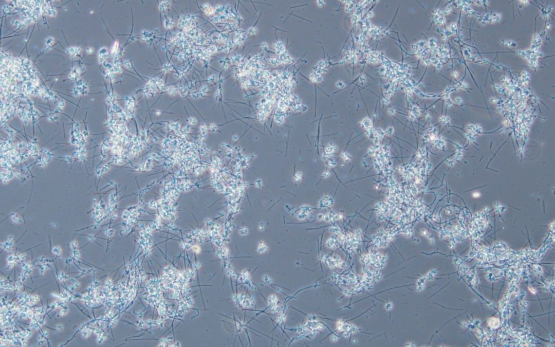 Filamentous Bacteria in Aerated Stabilization Basins: Part 1