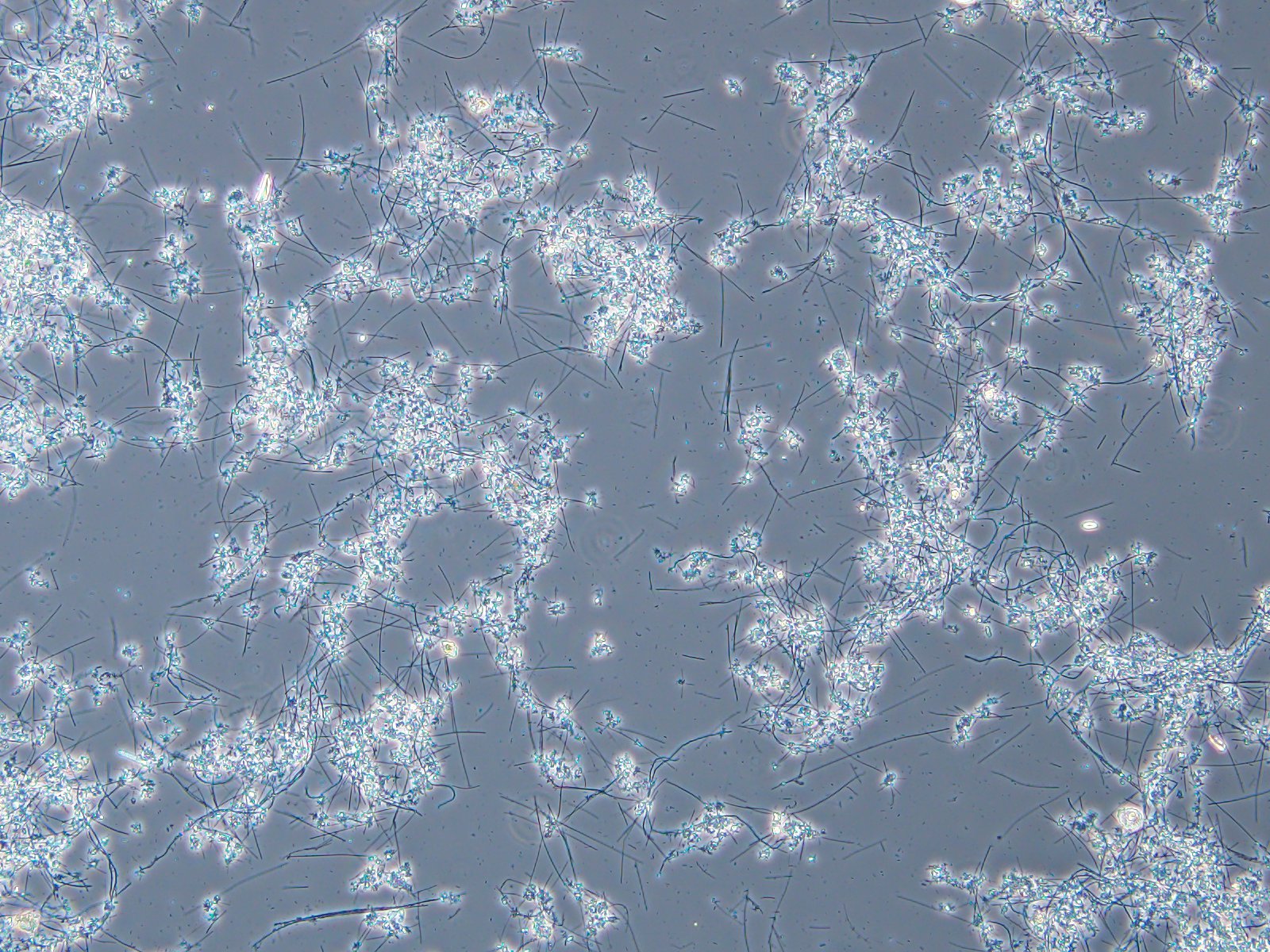 Filamentous Bacteria in Aerated Stabilization Basins: Part 1